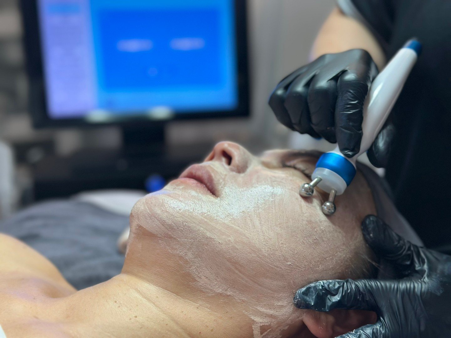 What's your biggest skin frustration right now? Drop a comment or DM me. I love helping you get real results. If you want a quick chat, I&rsquo;ll share my number once we connect and I understand your situation. #beautyjourneystudio #Hyperpigmentatio