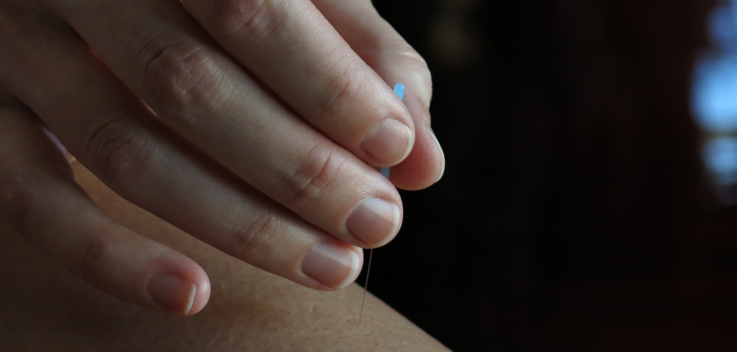 Aura uses a gentle needling technique
