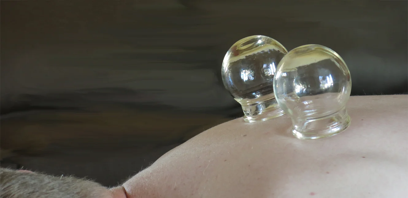 Cupping for pain relief and detoxification