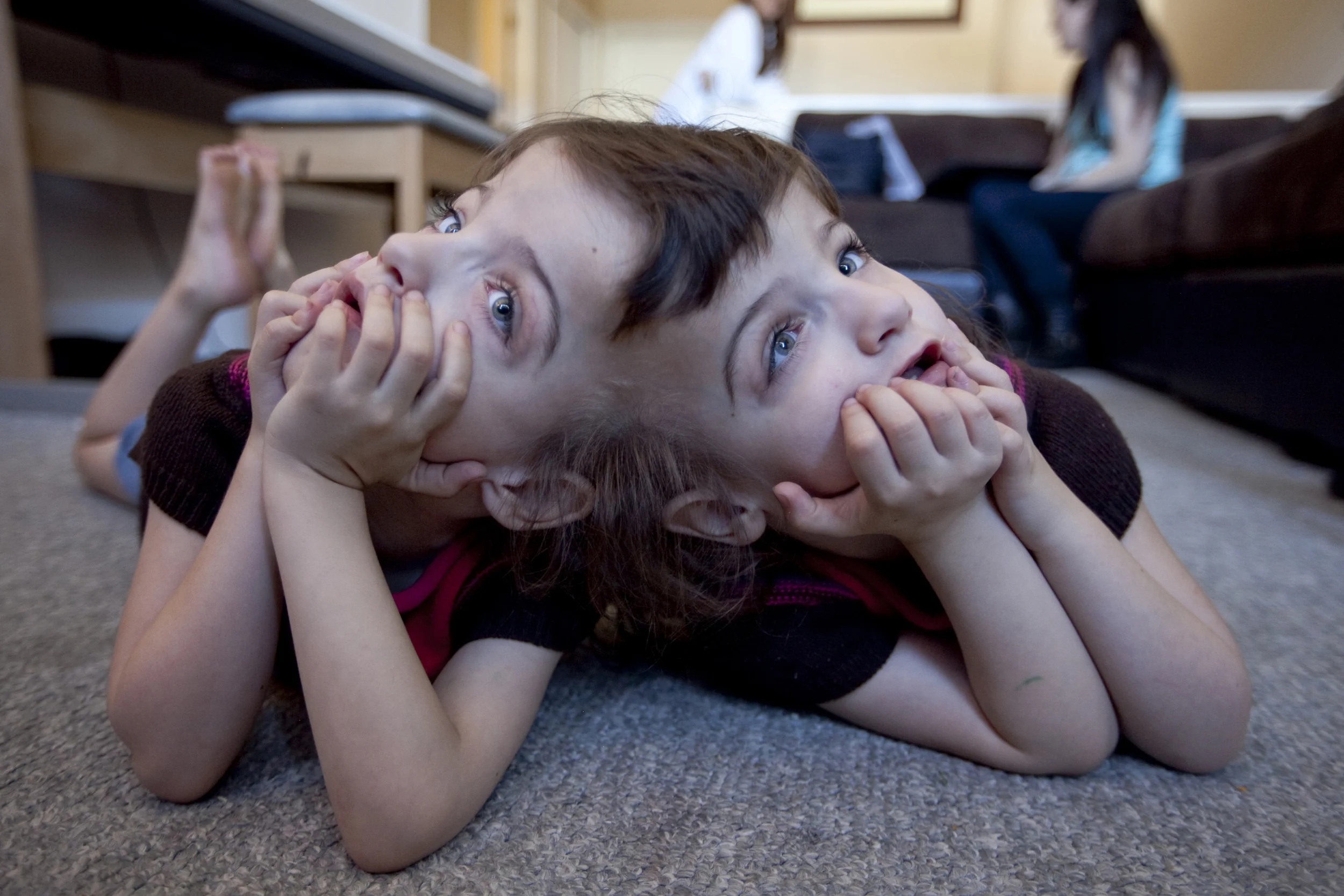 Conjoined twins Tatiana and Krista Hogan watch Miley Cyrus in their grandma's living room in Vernon, B.C.