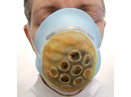 Screened for Rotavirus, 2015 Digital Print 16" x 16"