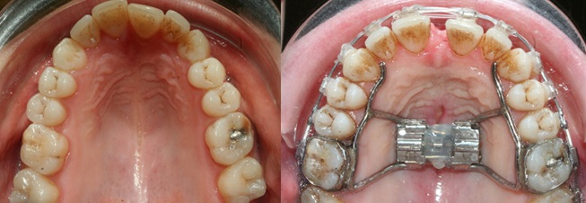 Indications et contre-indications therapeutiques — Orthodontie Rapide