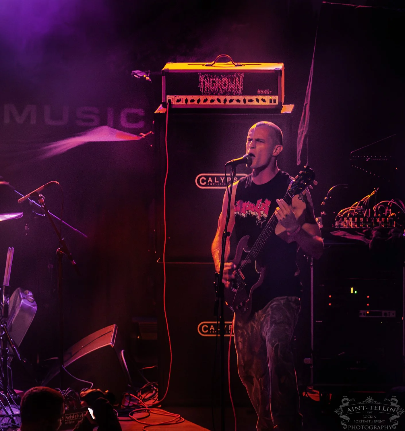ingrown 25_8685-Enhanced-NR.jpg