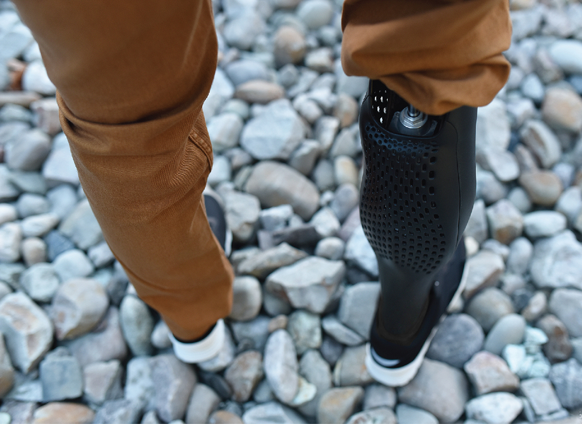 Beautifully crafted 3D printed prosthetic leg cover in the form of athletic leg muscles