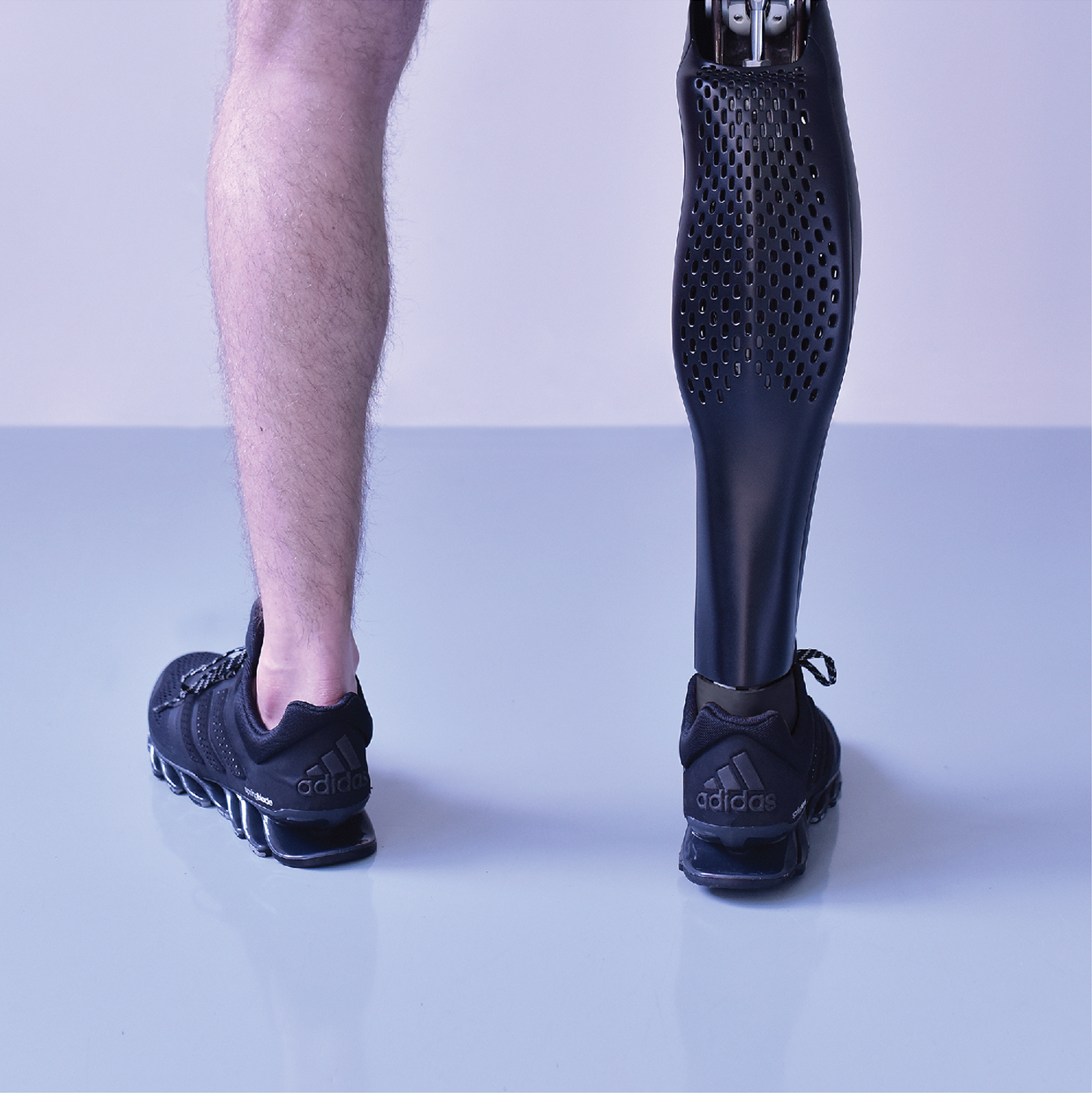 Beautifully crafted 3D printed prosthetic leg cover in the form of athletic leg muscles