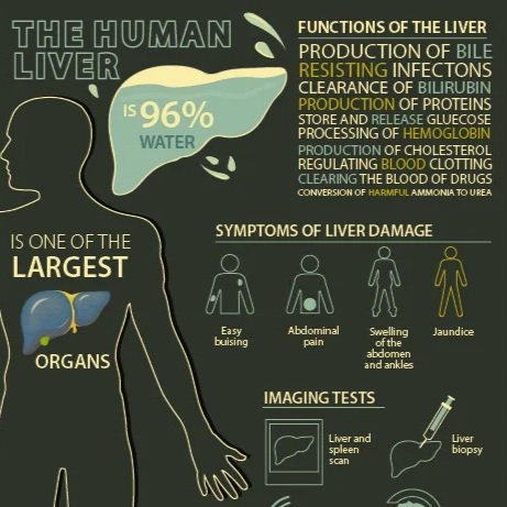 Infographics