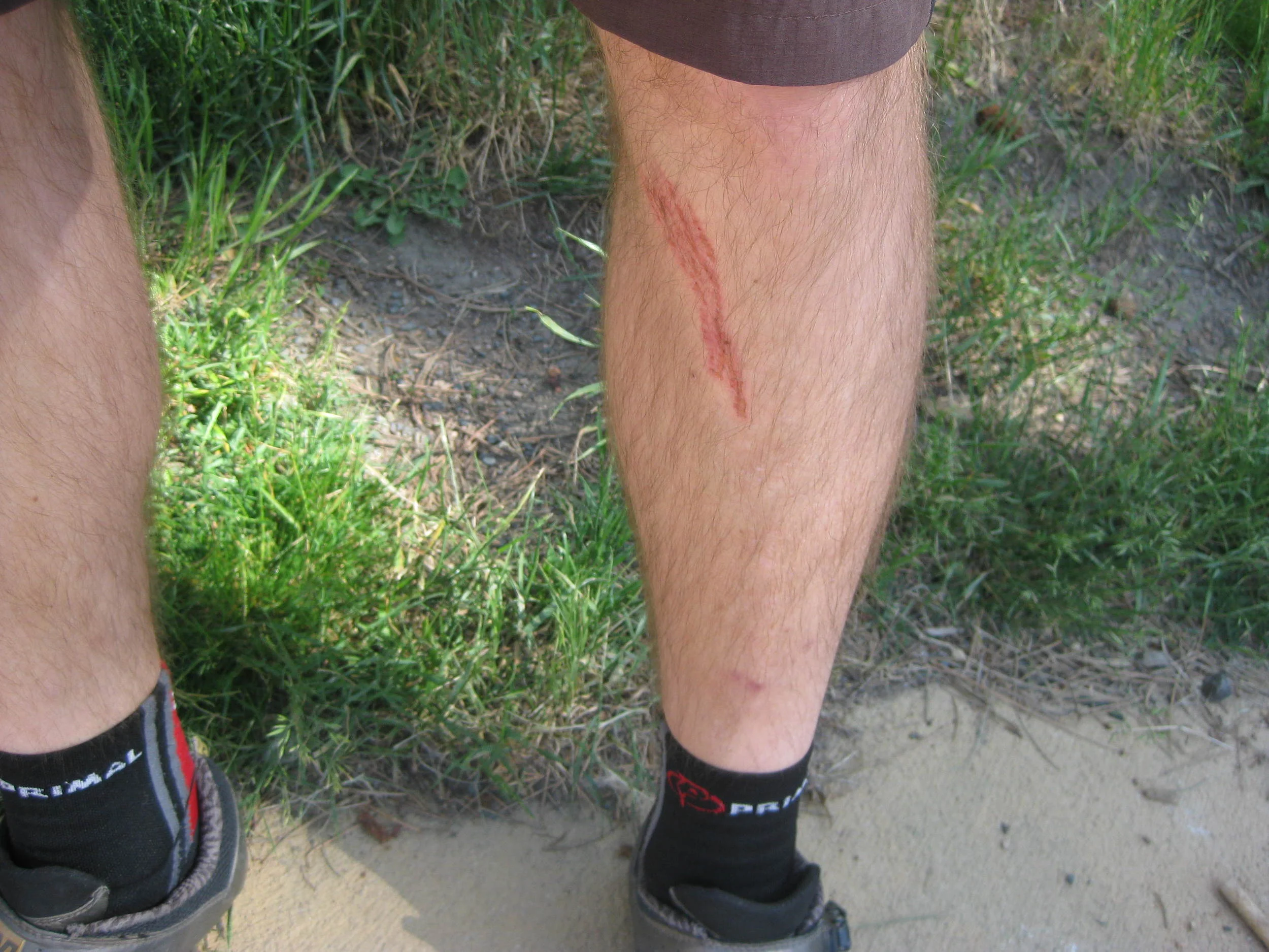 WORN OUT CLEATS WILL MAKE YOU UGLY. Replace them occasionally. Unless you enjoy picking scabs.