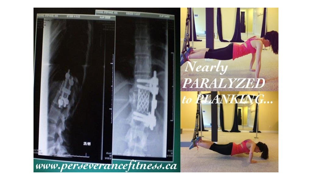 Nearly paralyzed to planking.