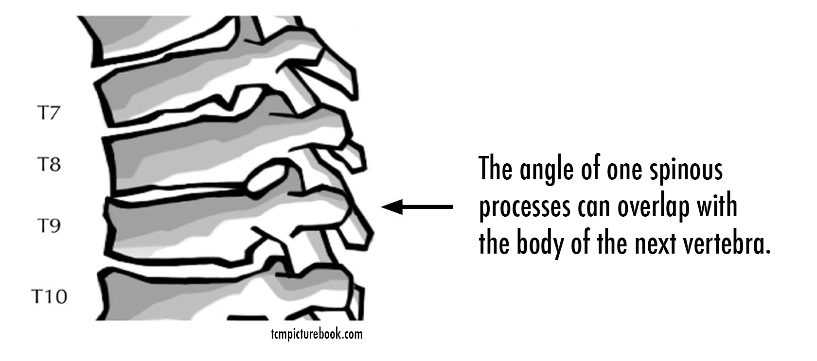 counting vertebra image.jpg