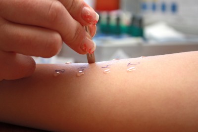 Allergy Clinic Appointments — Avid Allergy - Allergy Testing ...