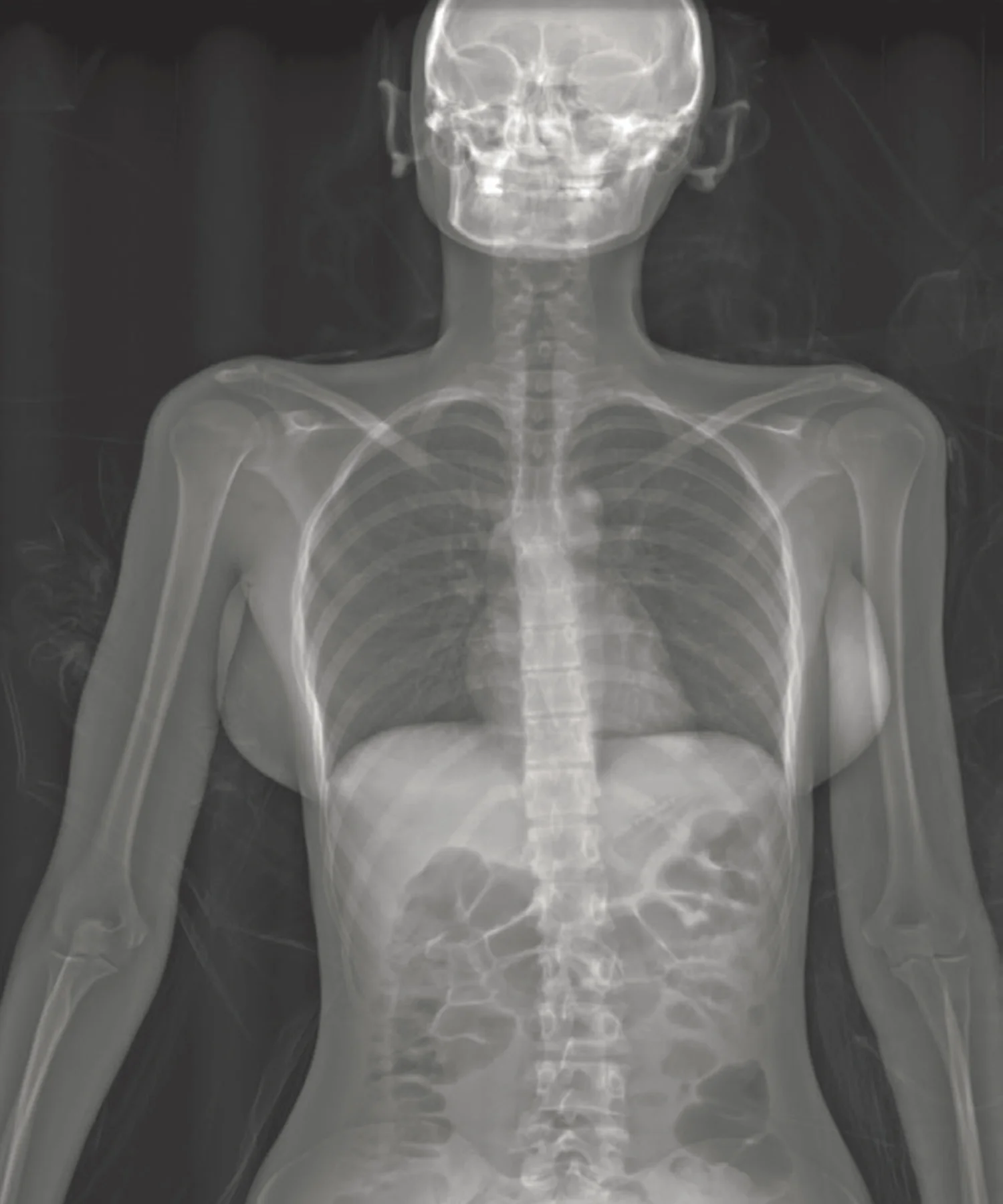 Xray crop.jpg