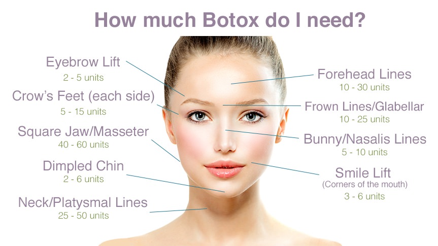 how-much-Botox-Dysport