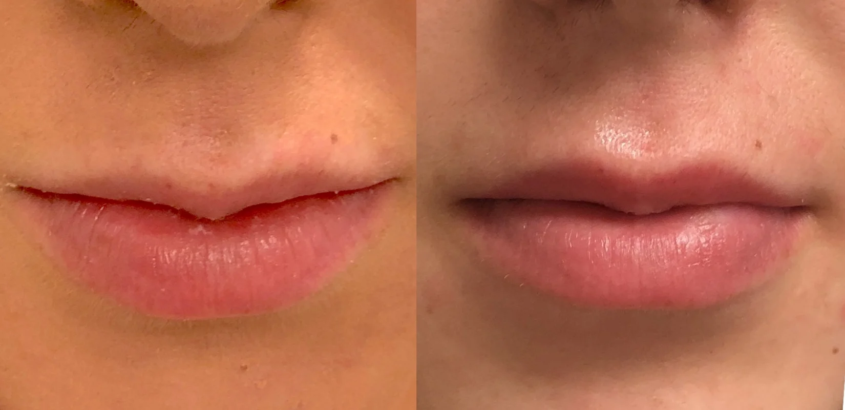 NMlips3.jpg