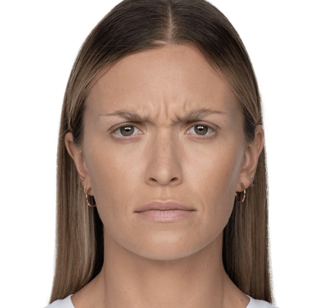 Skin after treatment