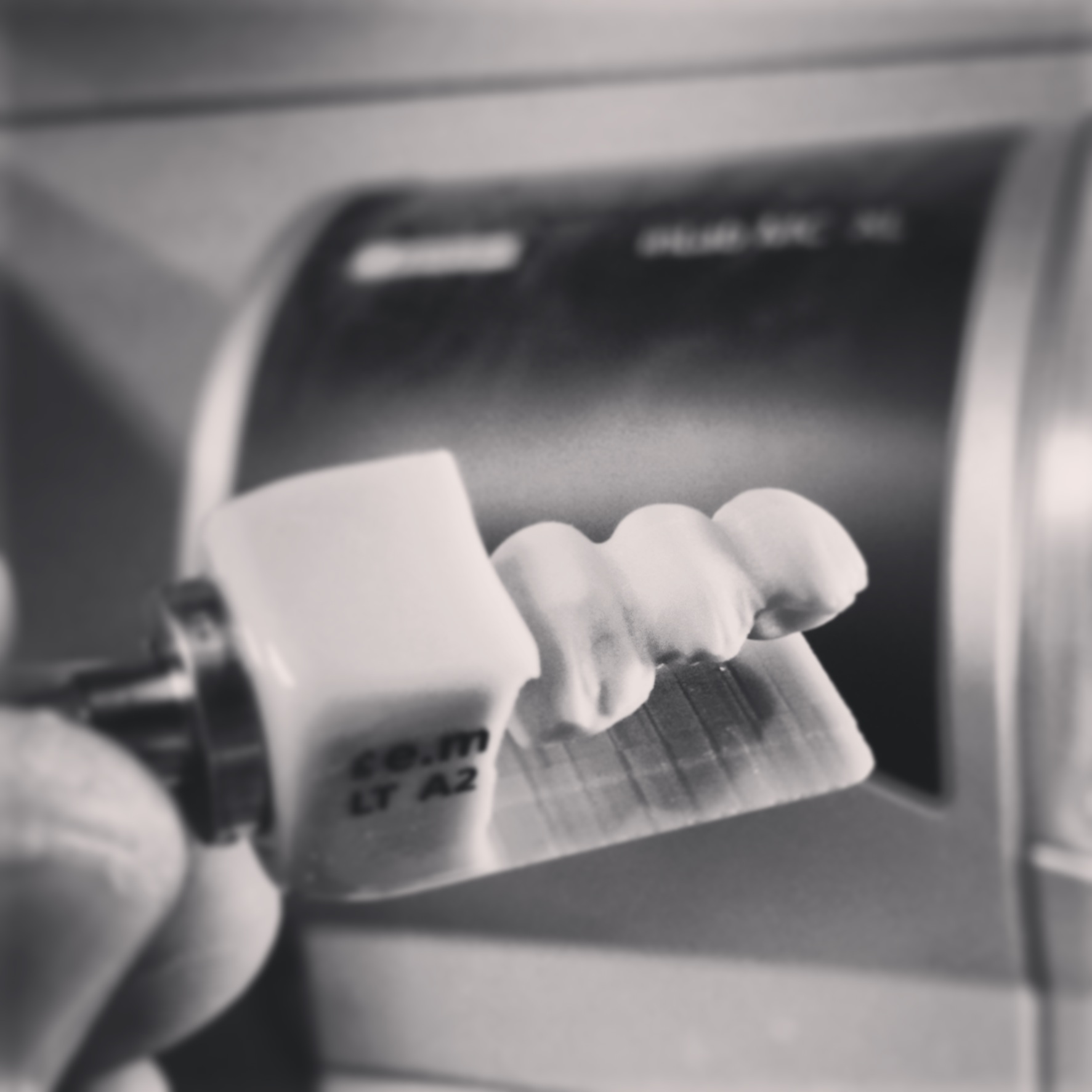 cerec.JPG