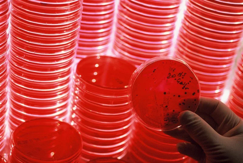 Agar_plates_microbiology_800x5362.JPG