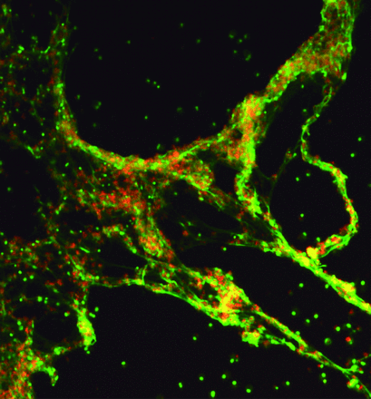 Faculty of 1000 Recommends JID Paper