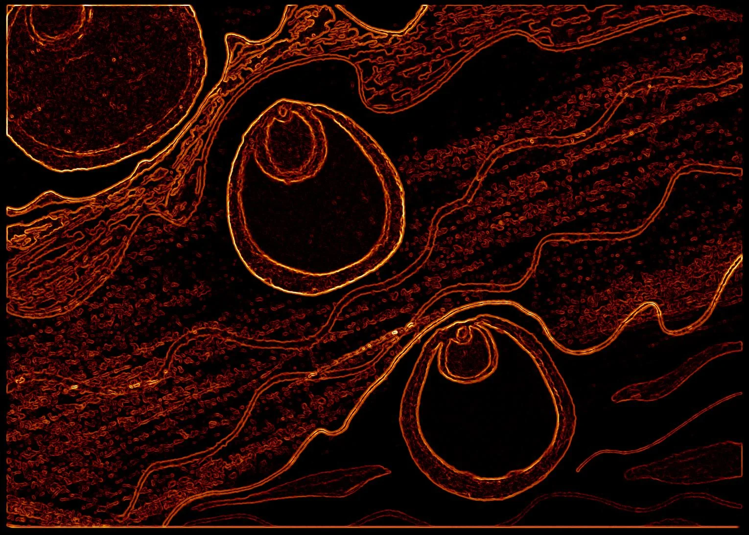 Endometrium2.jpg
