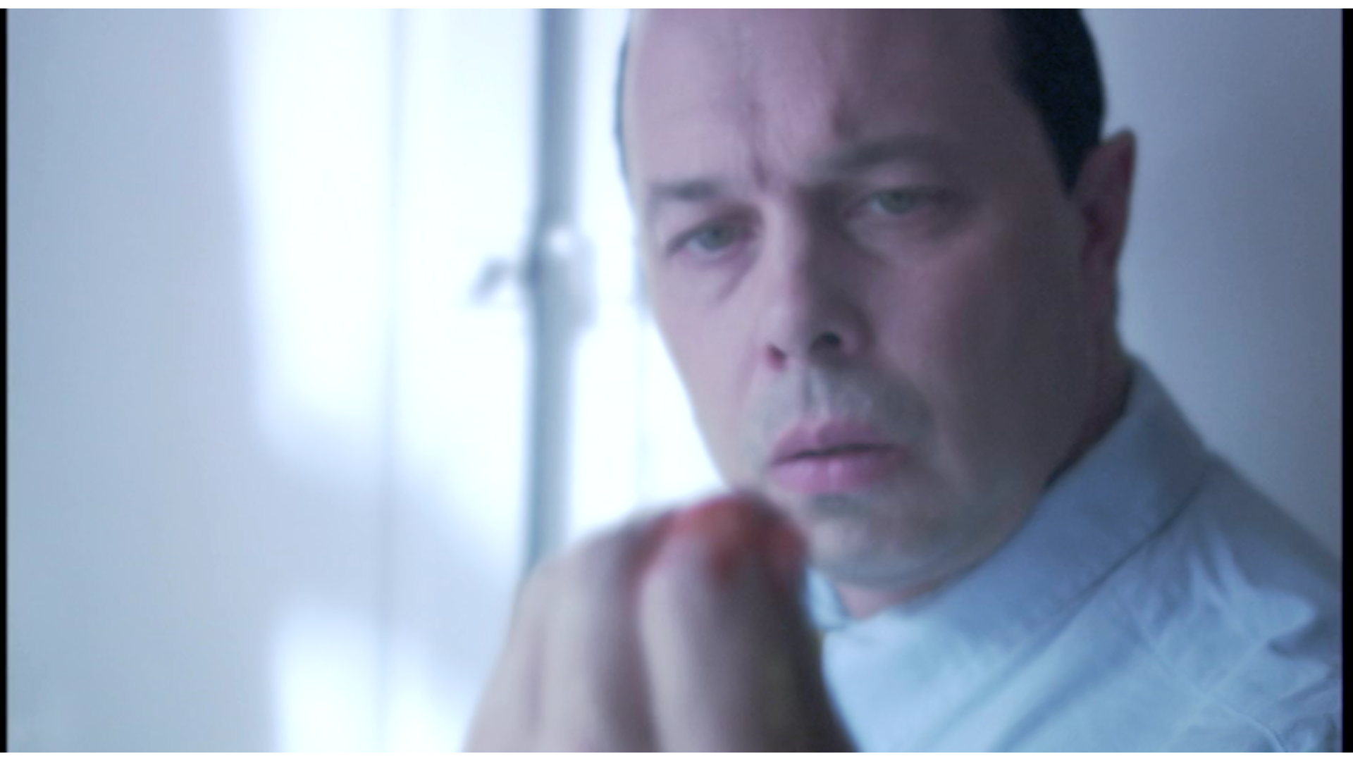 Close-up of a man with pale complexion and dark hair, looking intensely at the camera, wearing a hospital gown, in a medical setting with bright light.