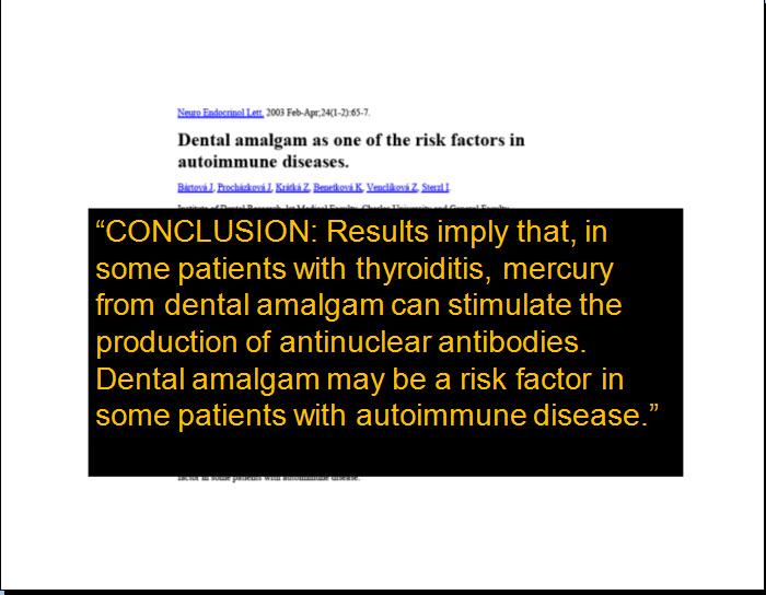 Amalgams-Autoimmunity.jpg