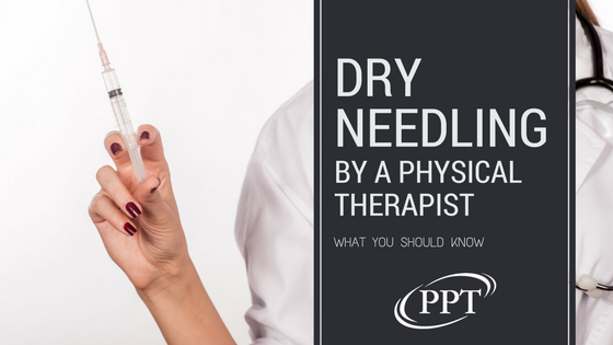 Dry Needling by a Physical Therapist: What You Should Know