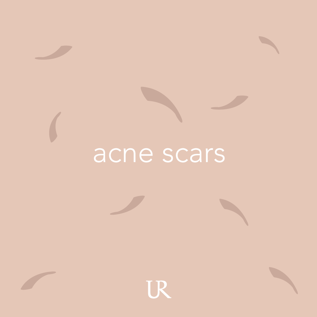 acne-scars.png