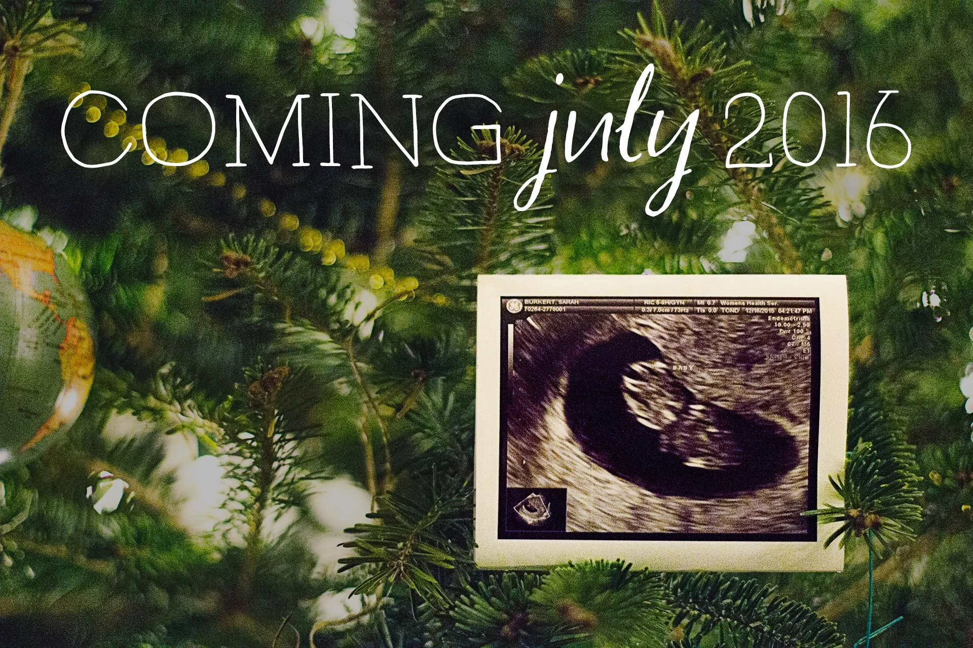 Our little one at 10 weeks