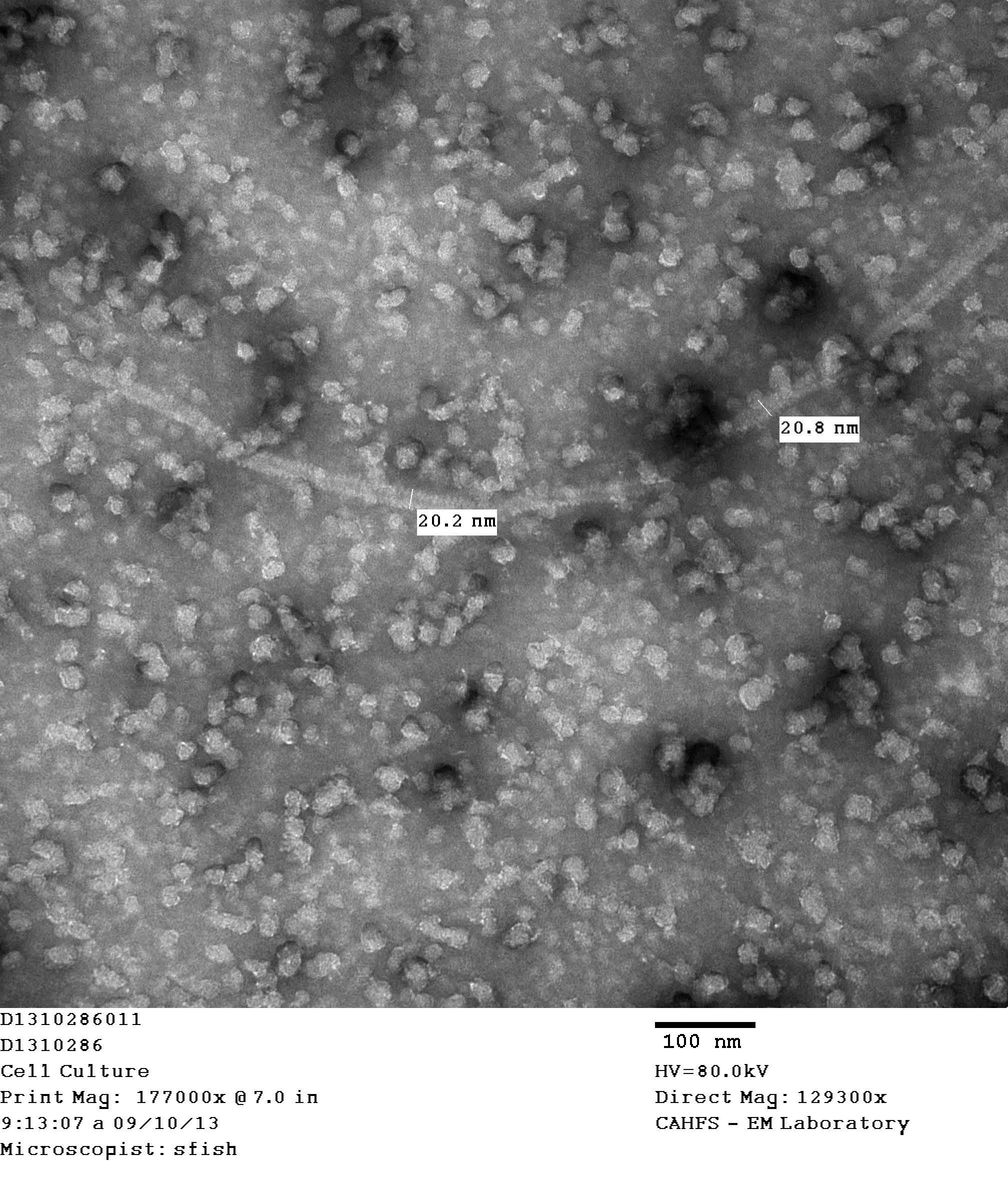 Electron micrograph showing dolphin morbillivirus viral particles in the cell culture from an infected bottlenose dolphin tissue. Photo: S. Fish, California Animal Health and Food Safety ( CAHFS ) Laboratory System. 