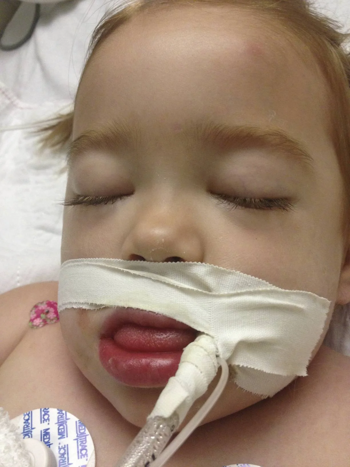 They started to worry about you being so puffy and we discussed dialysis.