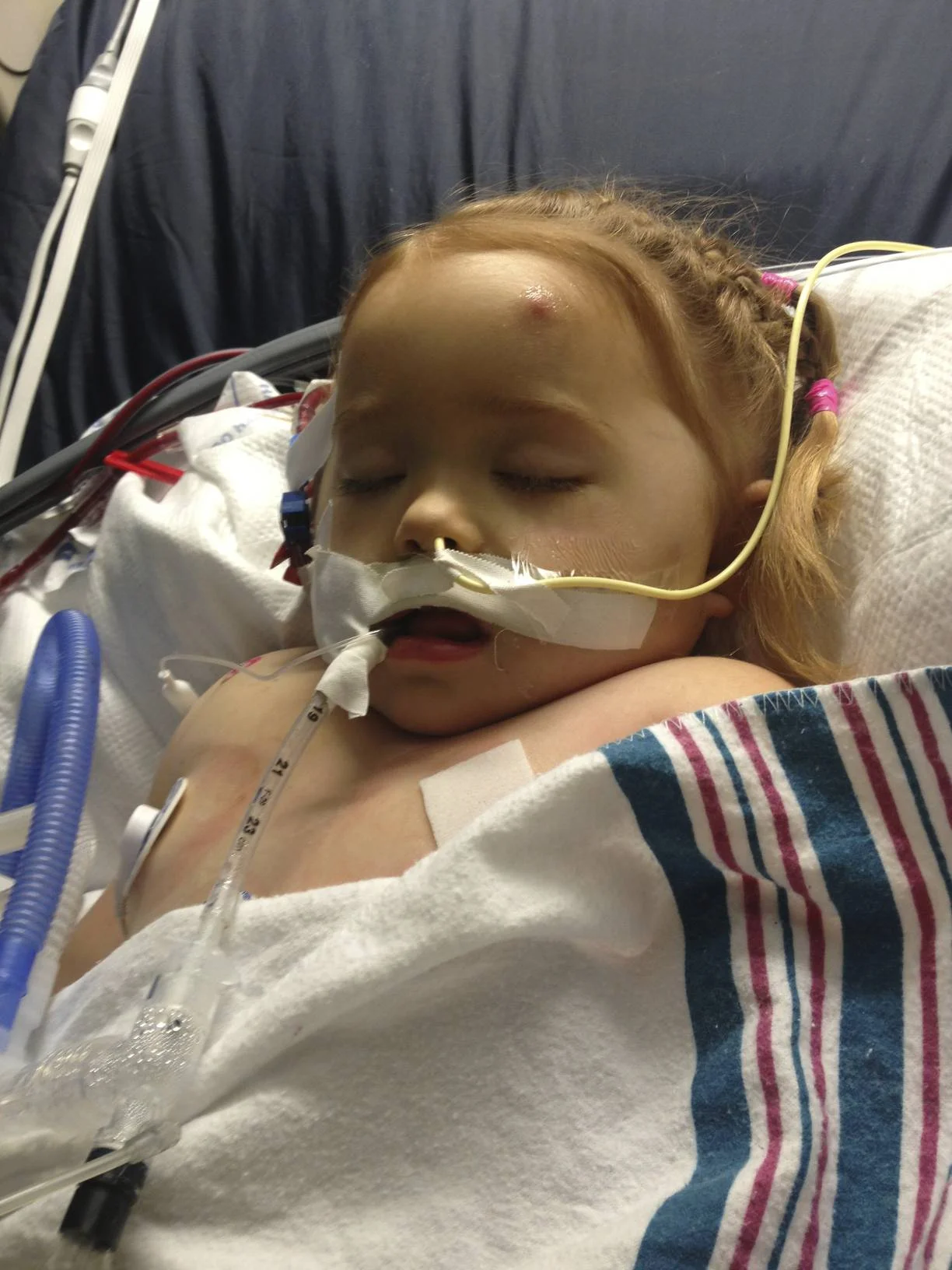 A feeding tube was added so you could start to get more nutrients.