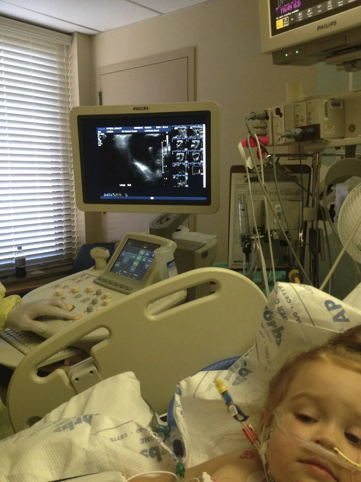 An ultrasound of your appendix.