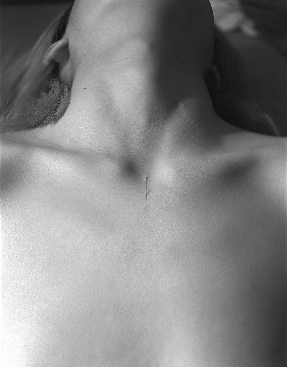 10_untitled(scratch on chest).jpg