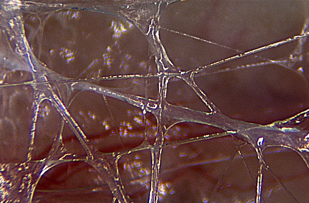 A microscopic view of the fascia shows the beauty of the interconnected web of tissue which creates all of our deep yin layers of the body