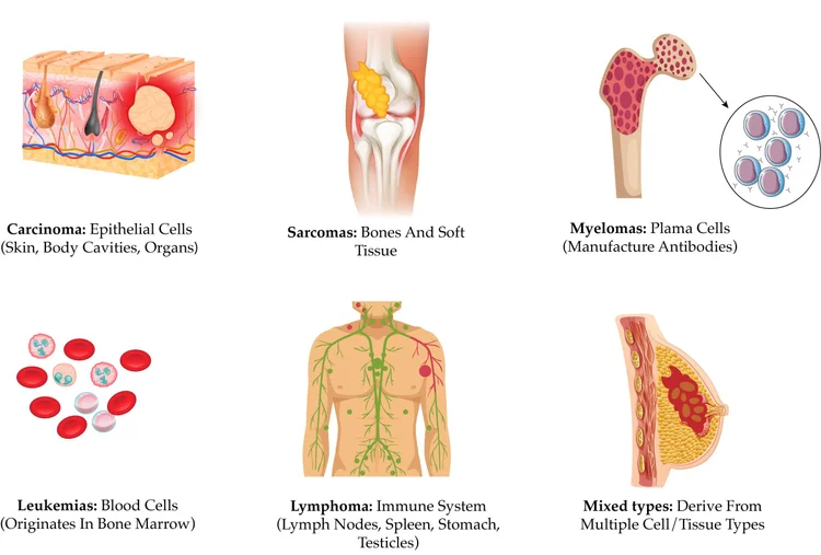 How Many Cancer Types Decoding the Human Genome: Empowering Cancer Treatment Research with ...