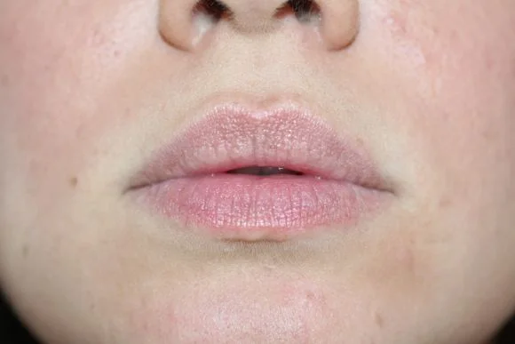 Bare lips