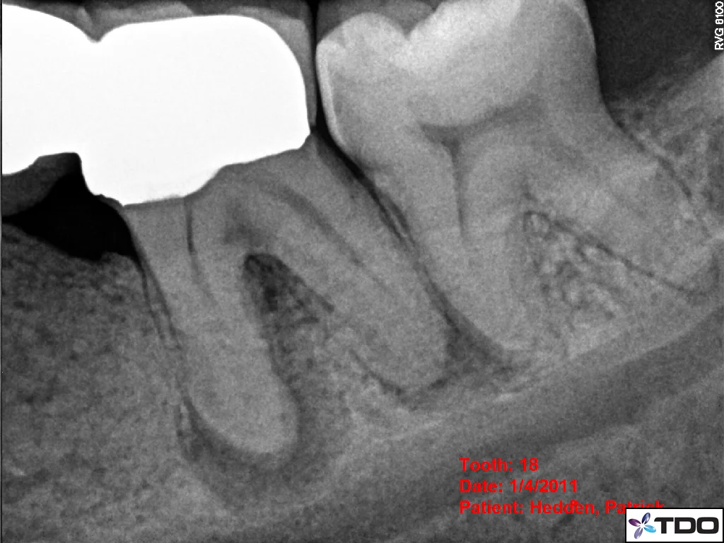  PRE-OP 2011