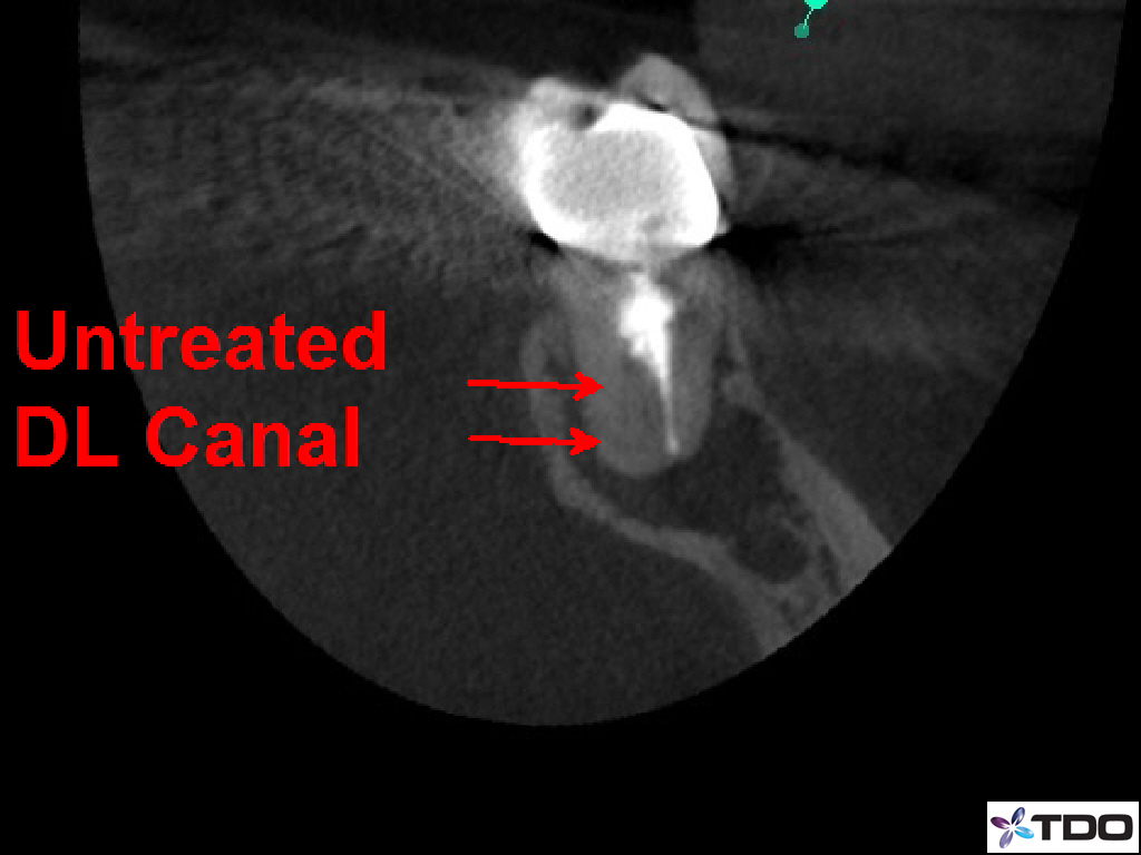  CBCT Coronal View