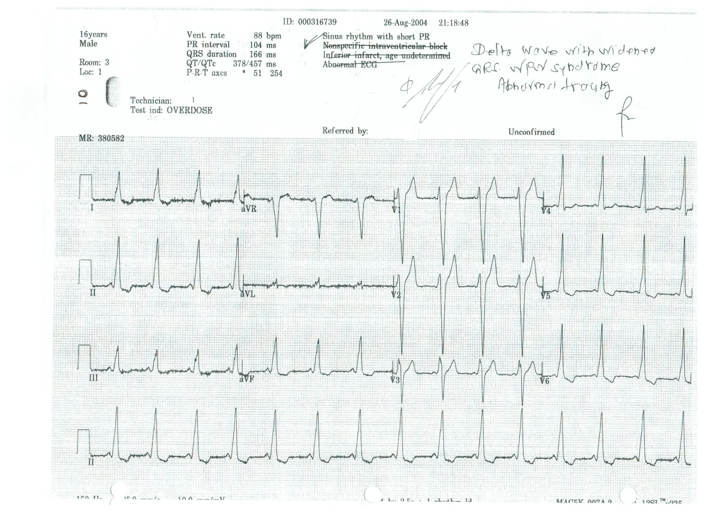 EKG 10.jpeg
