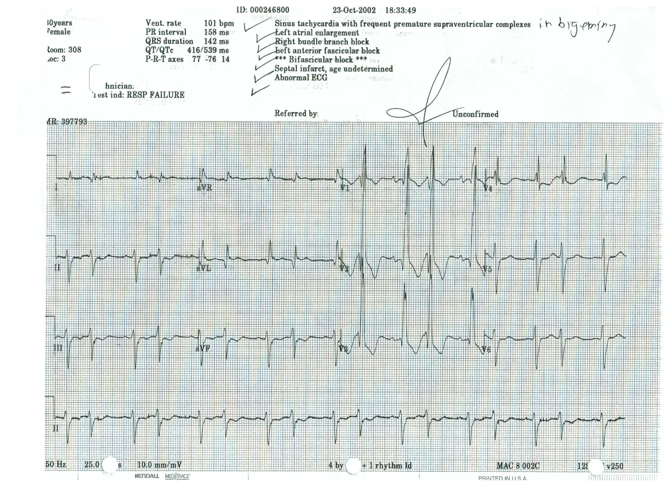 EKG 11.jpeg