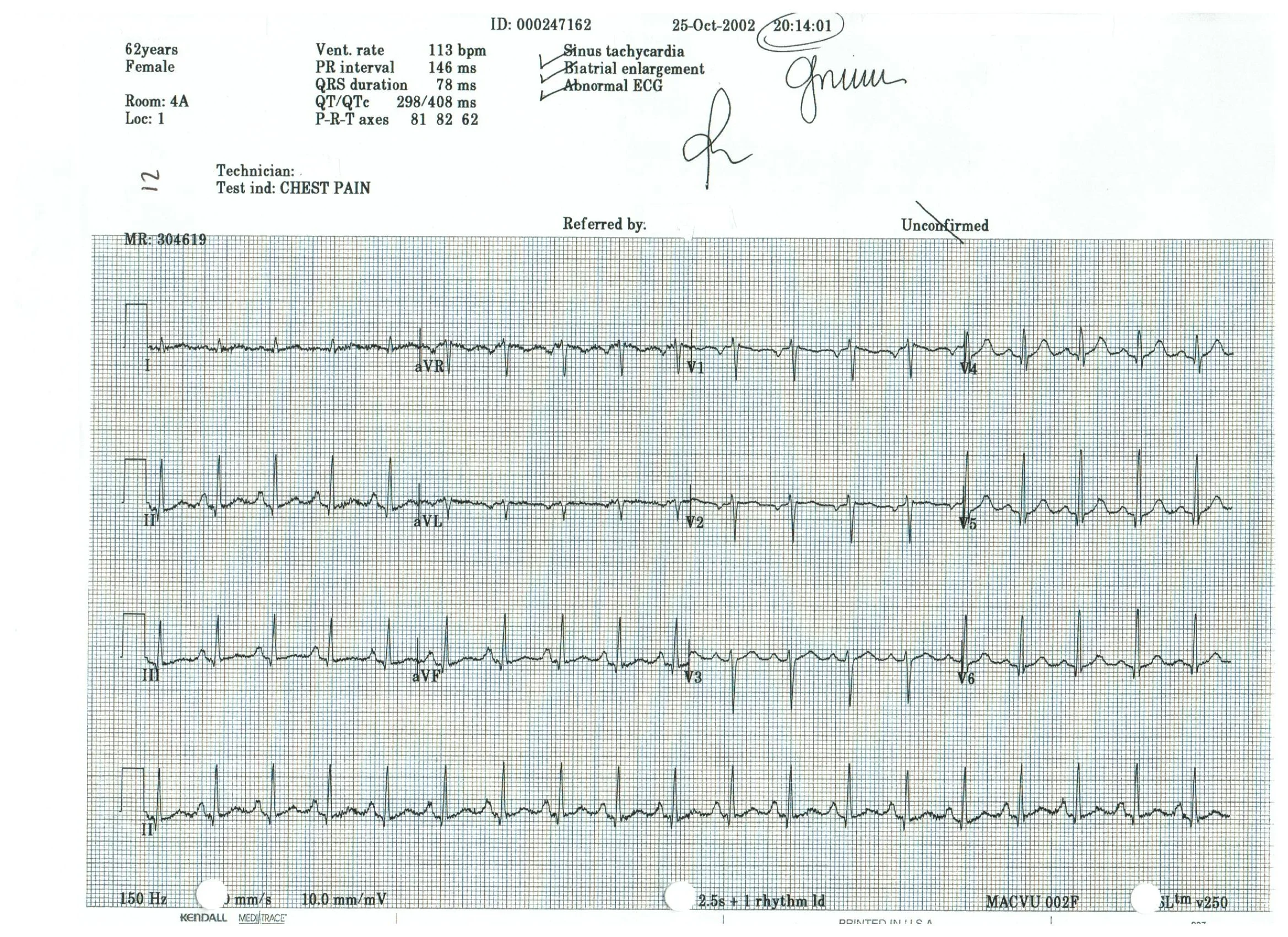 EKG 12.jpeg