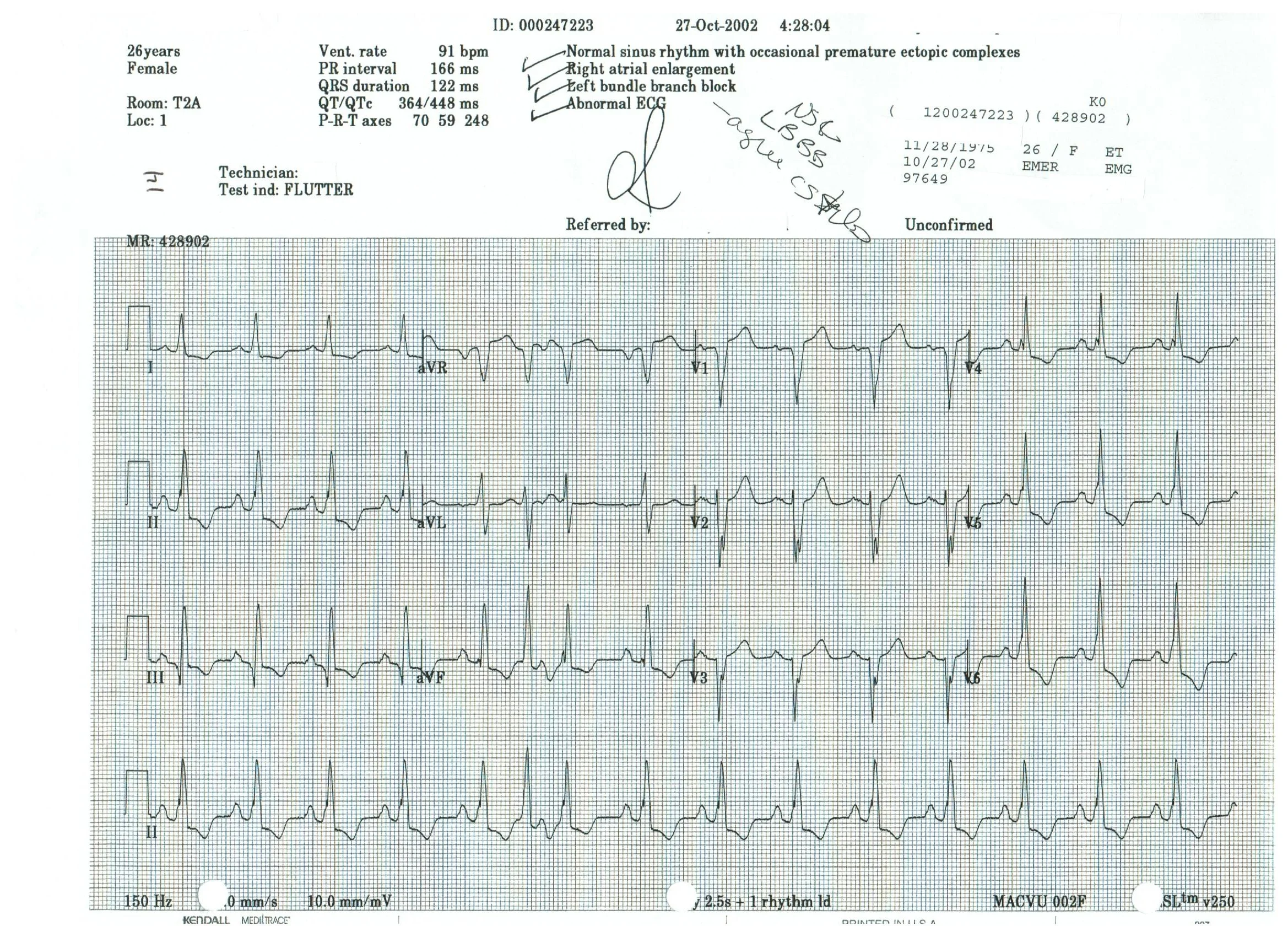 EKG 14.jpeg