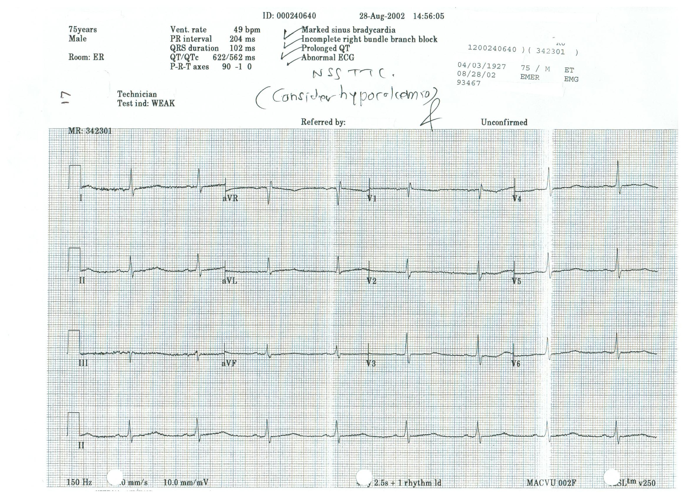 EKG 17.jpeg