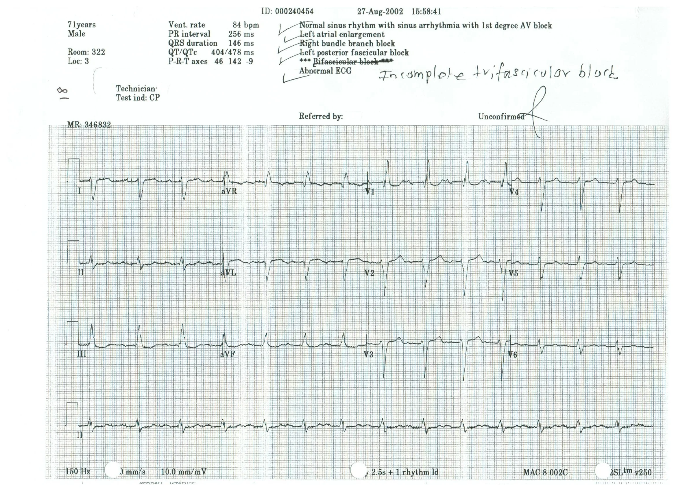 EKG 18.jpeg