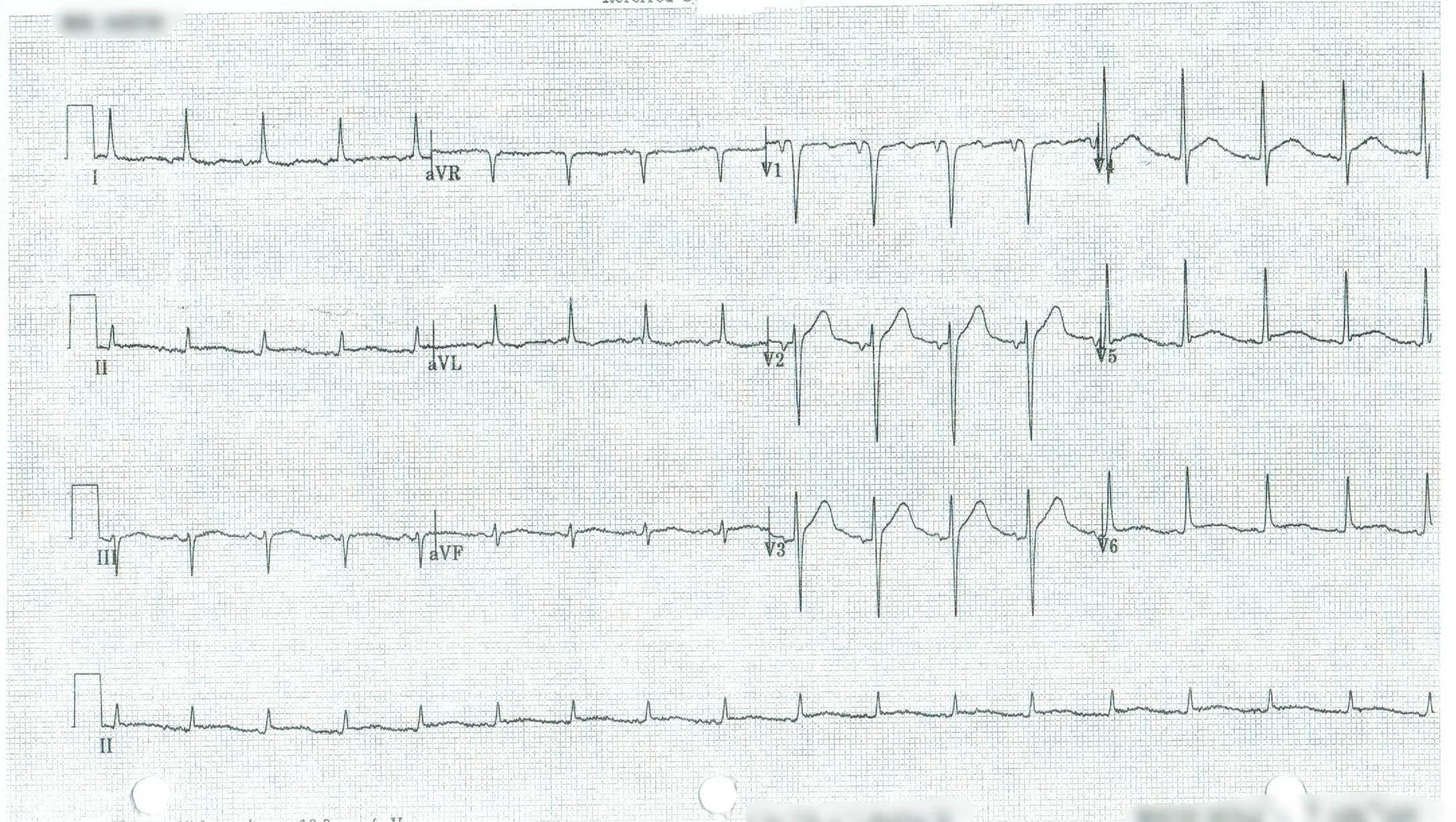 EKG 2.jpeg