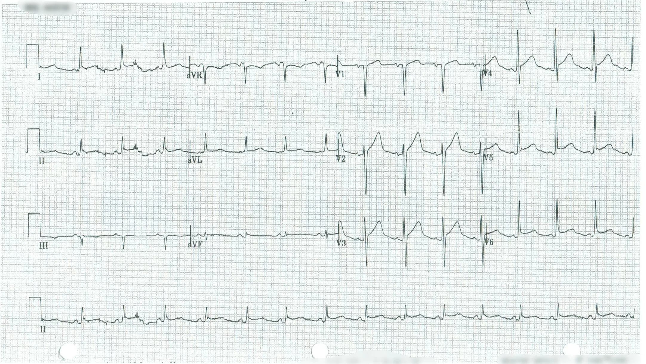 EKG 4.jpeg