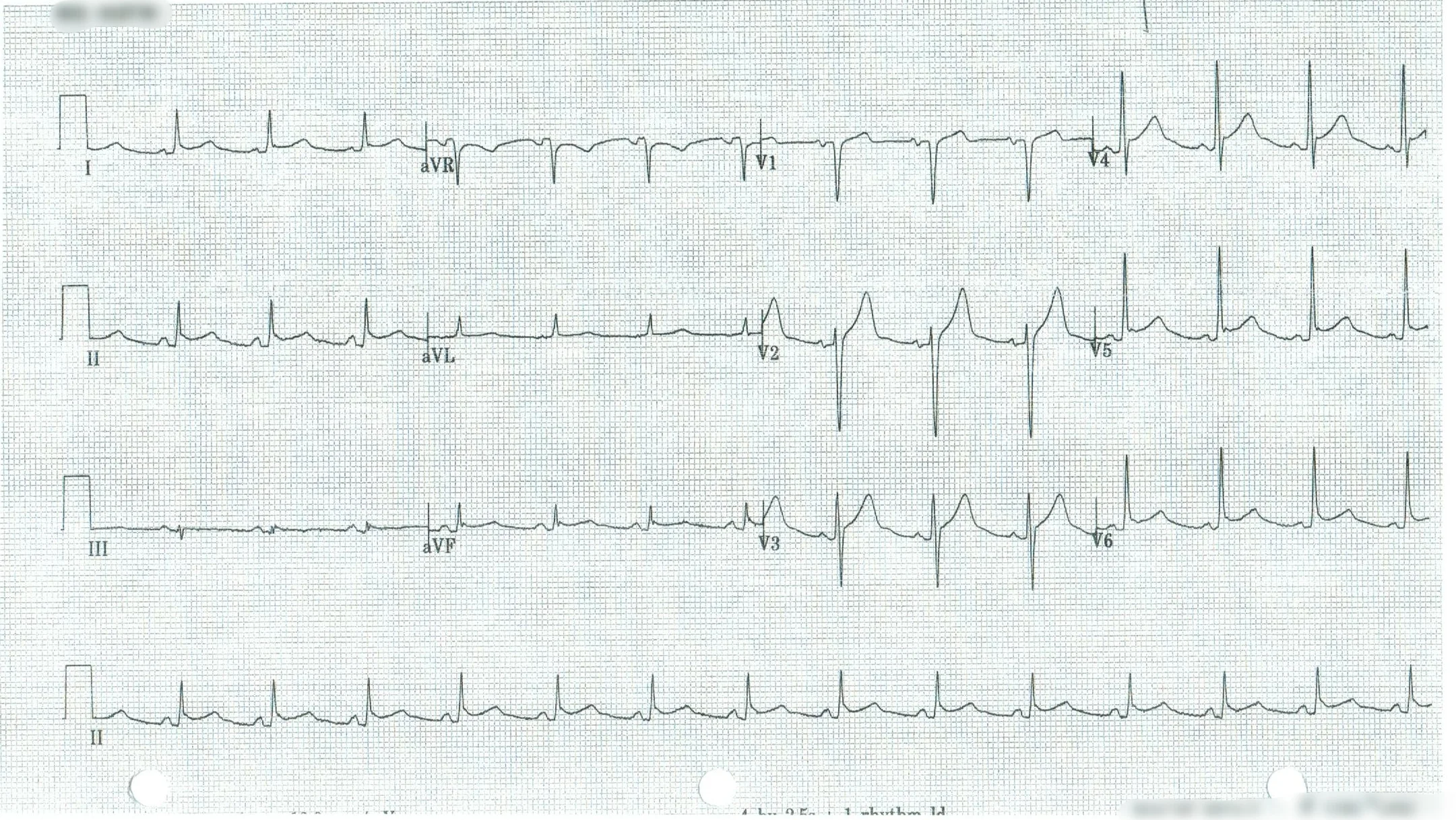 EKG 5.jpeg