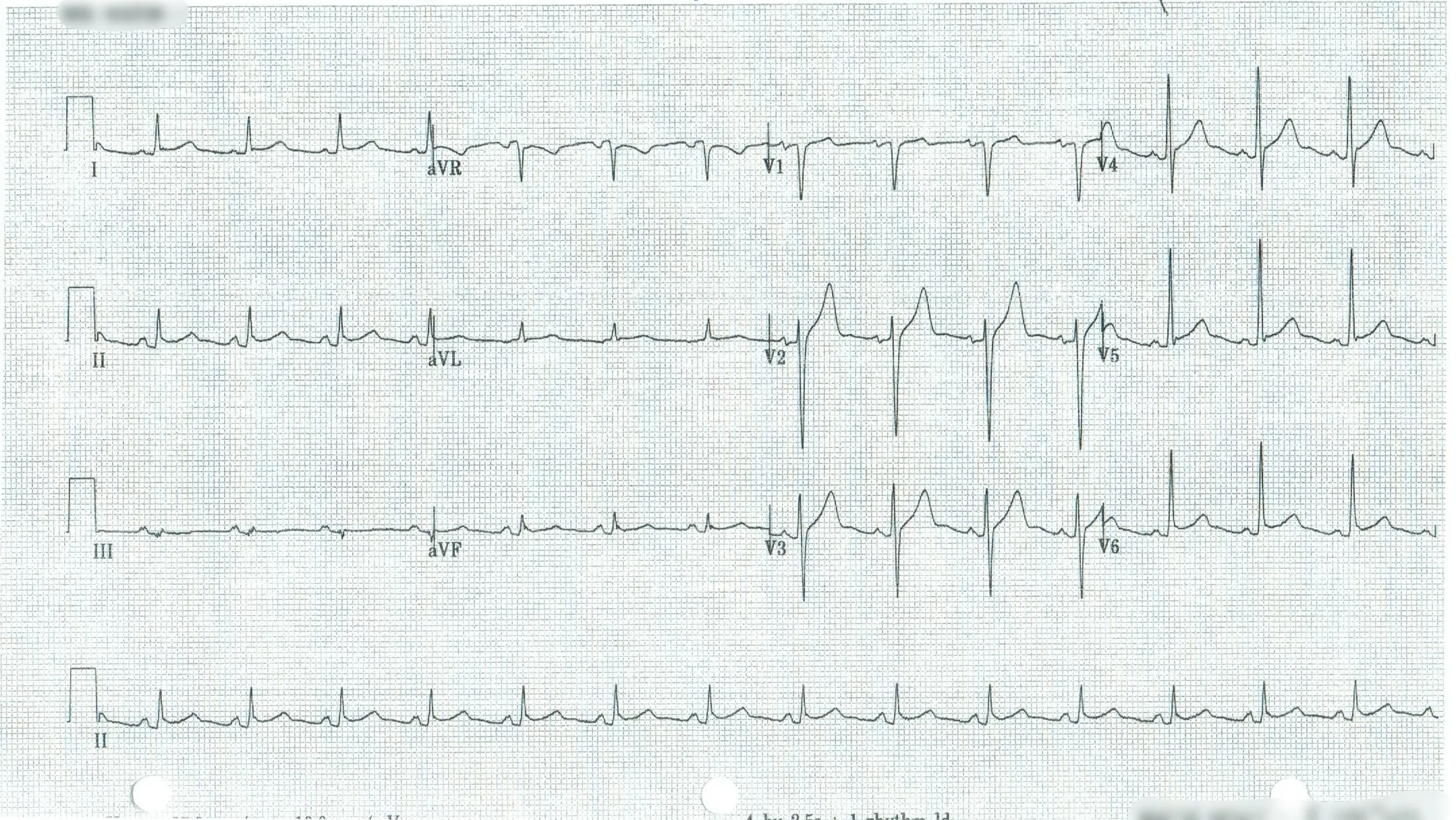 EKG 6.jpeg