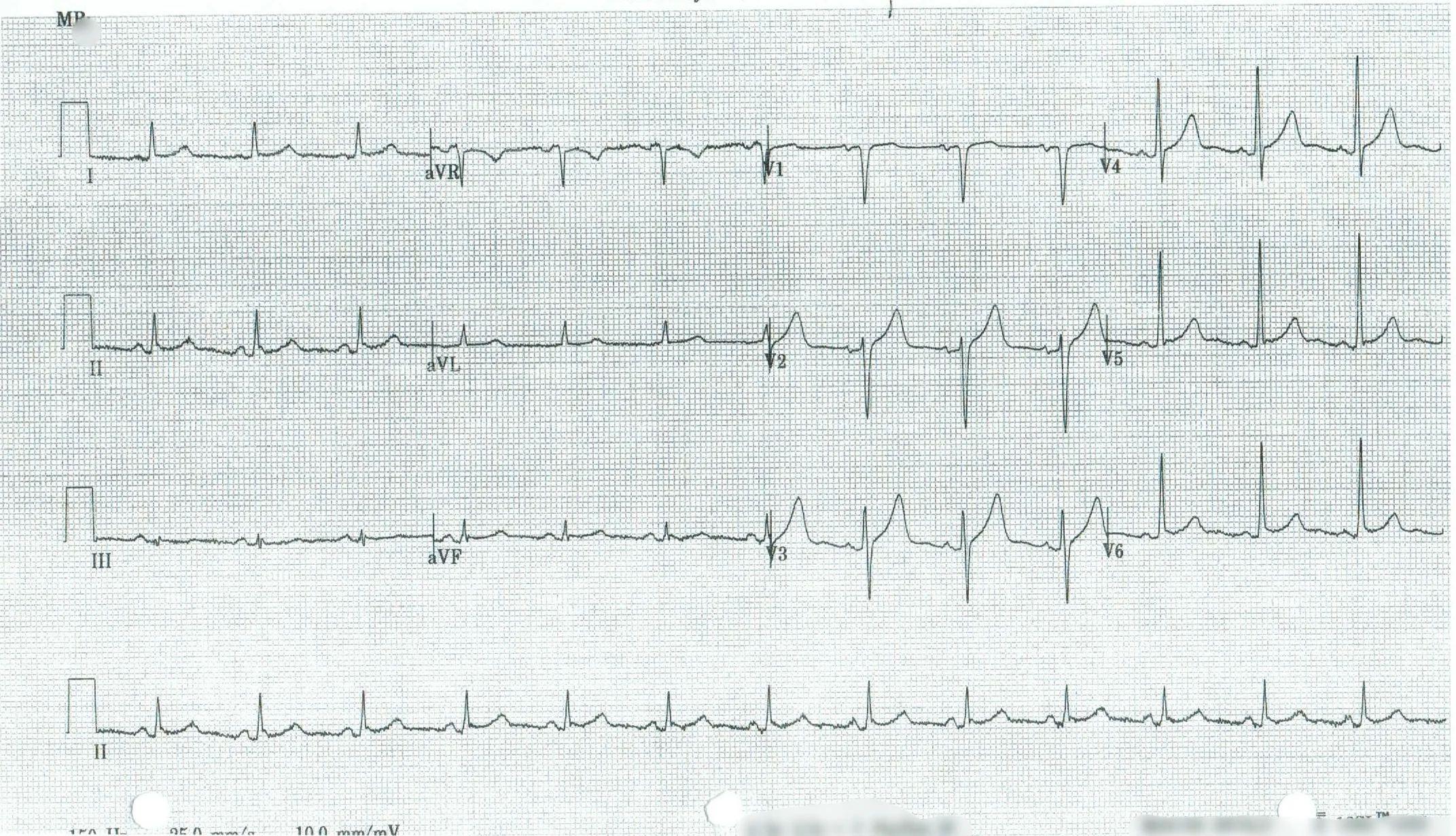 EKG 7.jpeg