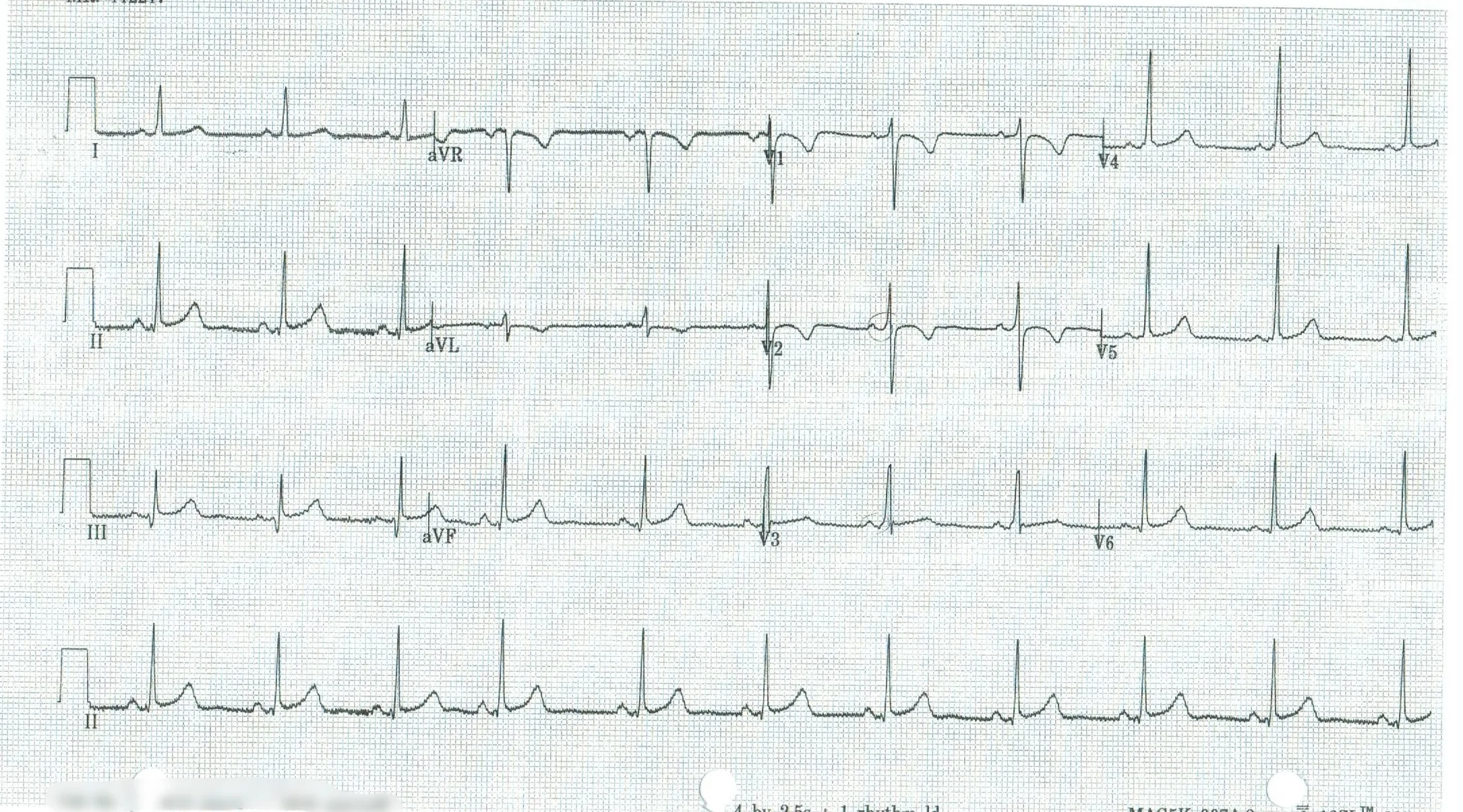 EKG 8.jpeg