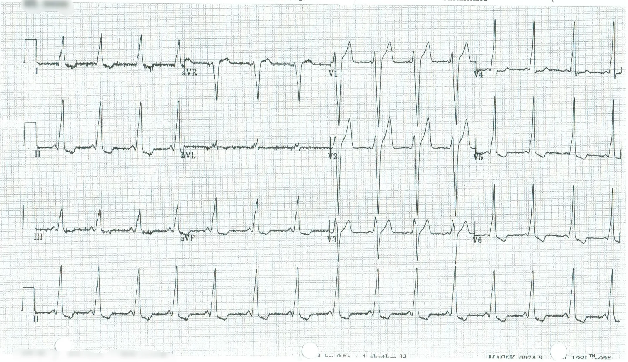 EKG 10.jpeg
